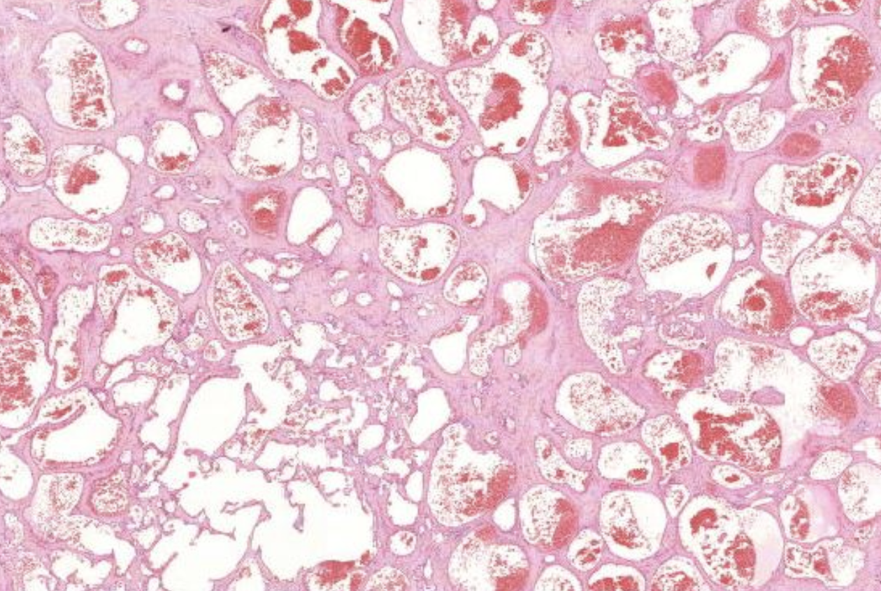 Histopathologisches Bild: Kolonschleimhaut